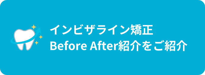 マウスピース矯正 インビザライン ビフォーアフター